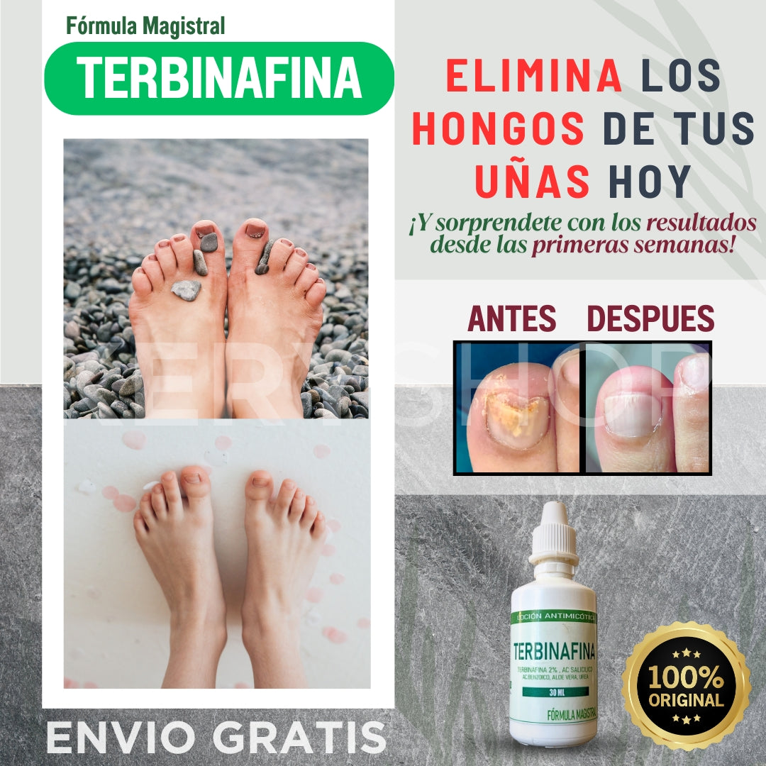 ADIOS A LOS HONGOS: TERBINAFINA EN GOTAS PARA TUS UÑAS