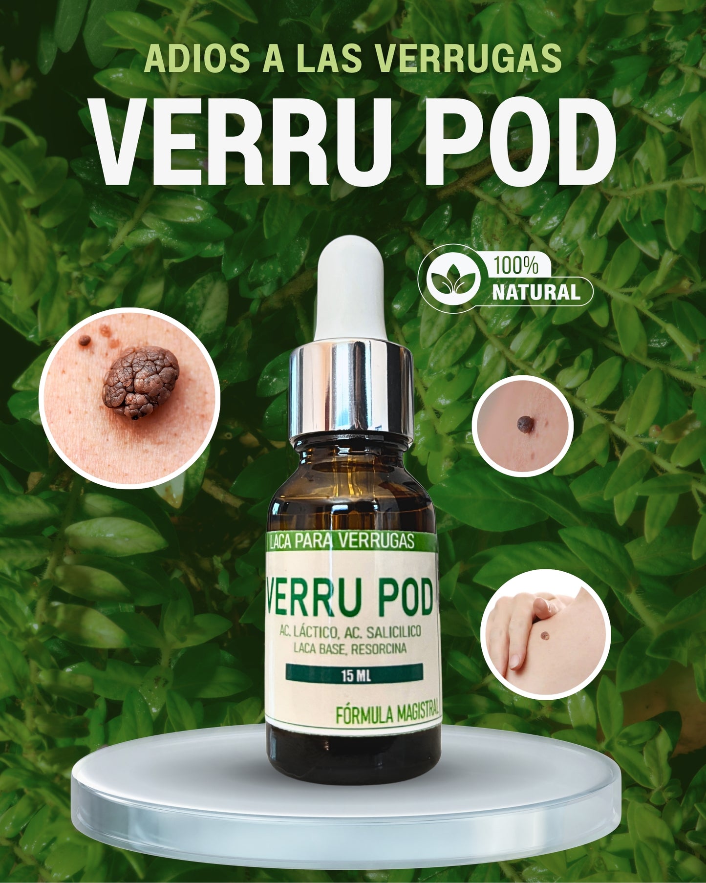 VERRU POD: Adiós a las verrugas