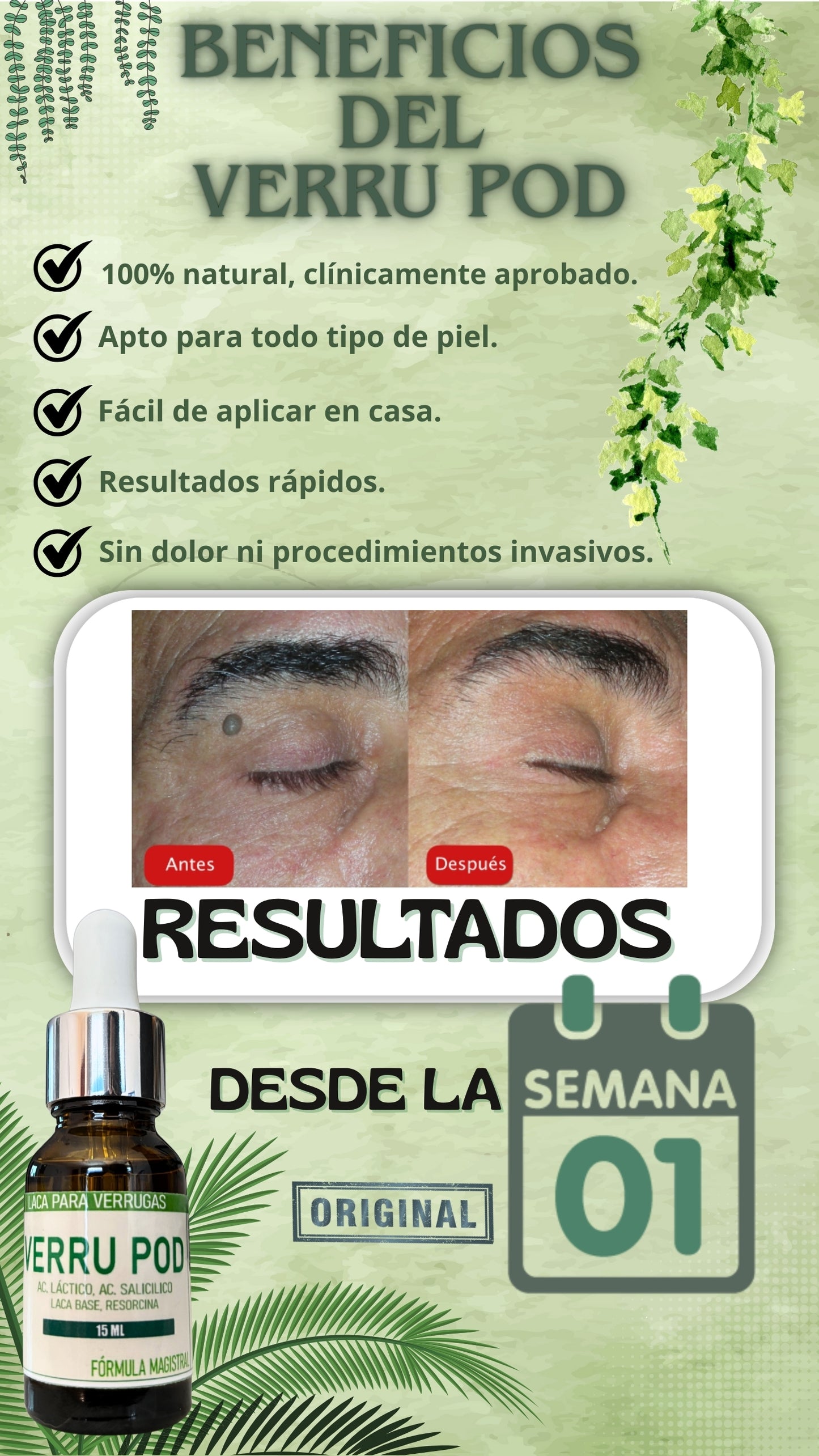 VERRU POD: Adiós a las verrugas