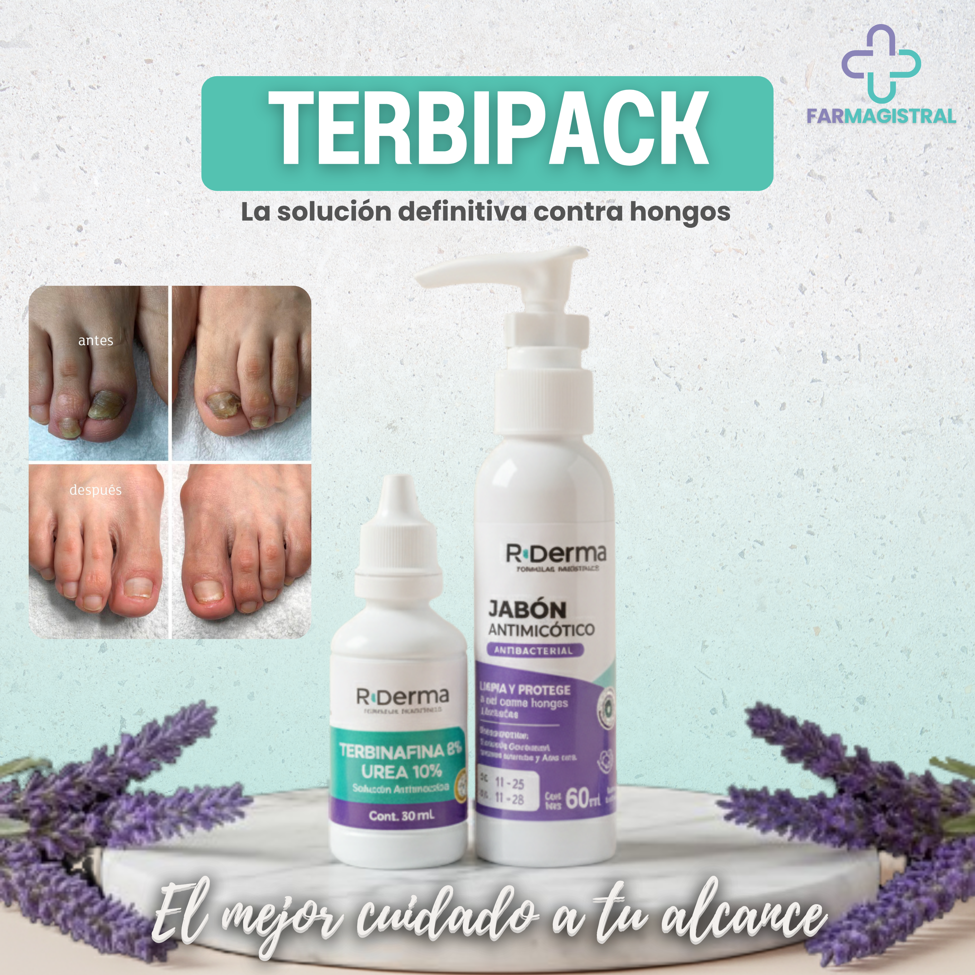 TERBIPACK (Terbinafina 8% y Urea 10 + Jabón Terbinafina)